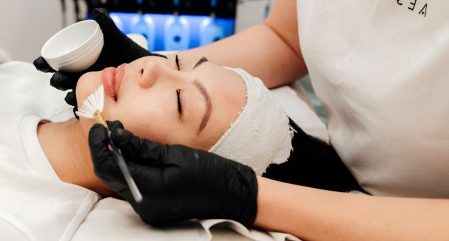 lady receiving a Cosmo forte peel