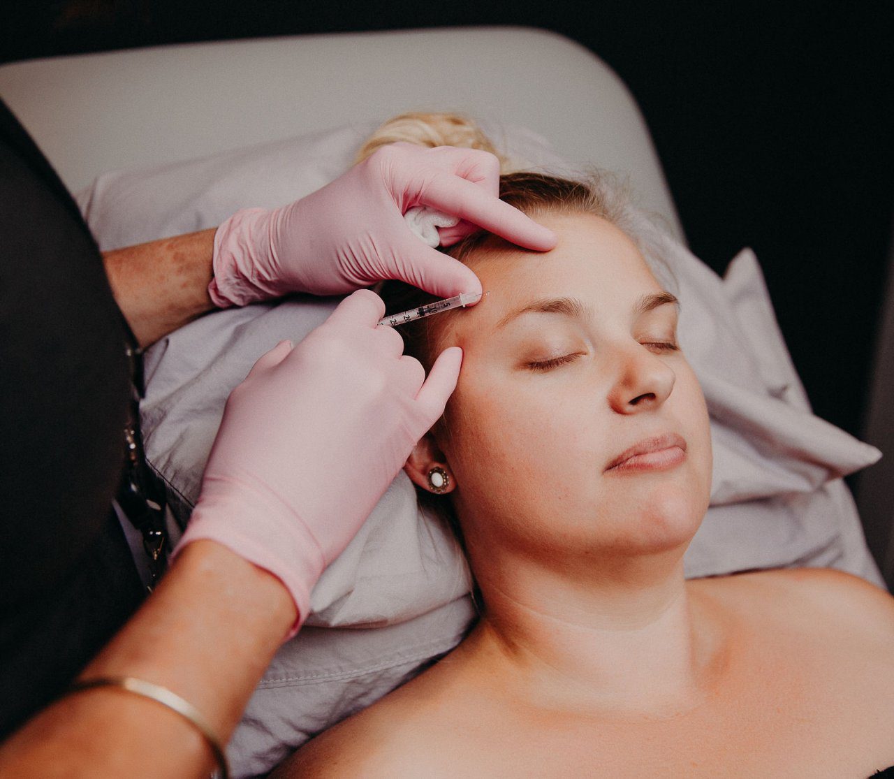 Woman with eyes closed has relaxers injected into her forehead