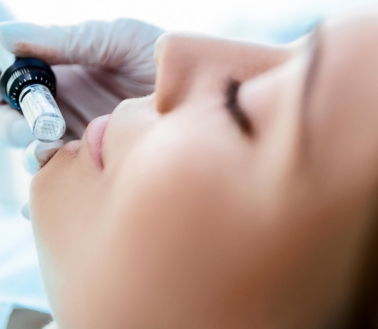 A person tilts their head back as needling is applied to their face