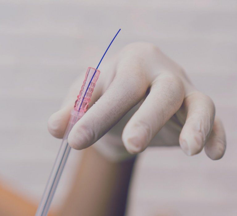 A gloved hand holding mono threads