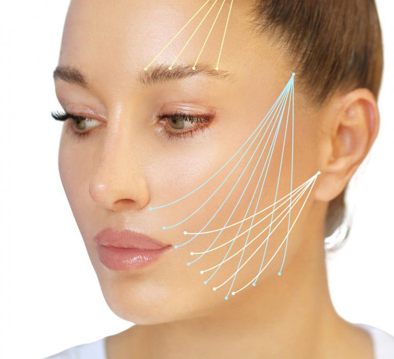 A woman's face with lines indicating certain areas