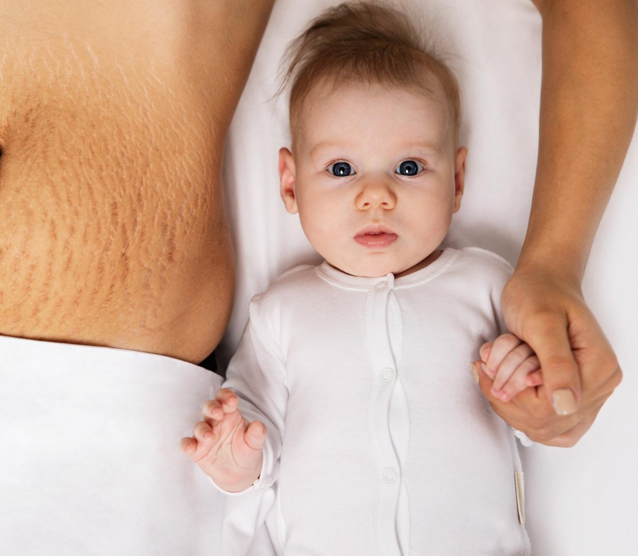A person with stretch marks beside a baby