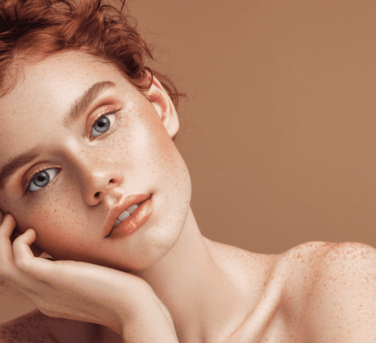 Woman with freckles leaning on hand