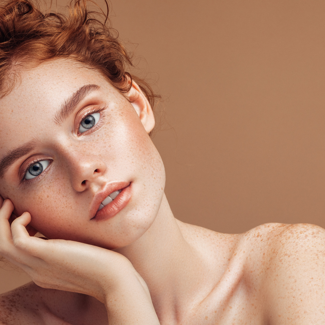 Woman with freckles leaning on hand