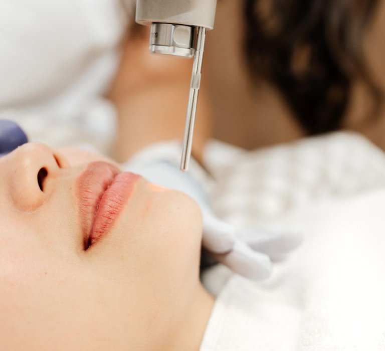 procedure for Dermal laser